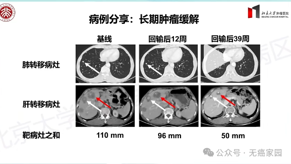 2026颠覆性突破！中国CAR-T疗法强势攻克胃癌、胰腺癌等实体瘤，治愈新希望来了！