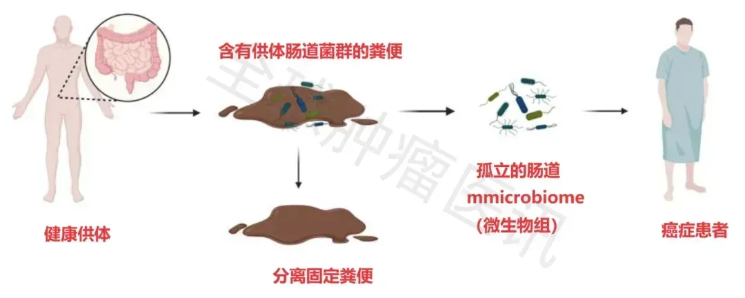 结直肠癌术后恢复有“良方”！益生菌让肠道功能快恢复、感染风险大降