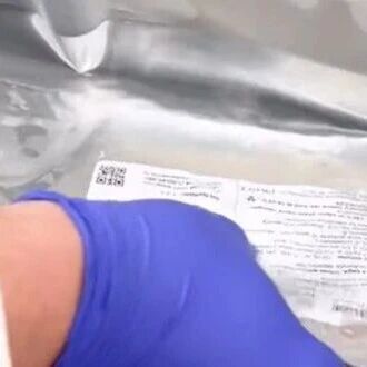 350万一针免费治疗！一次性TIL细胞让晚期癌症患者无复发迹象（NED），重获新生！