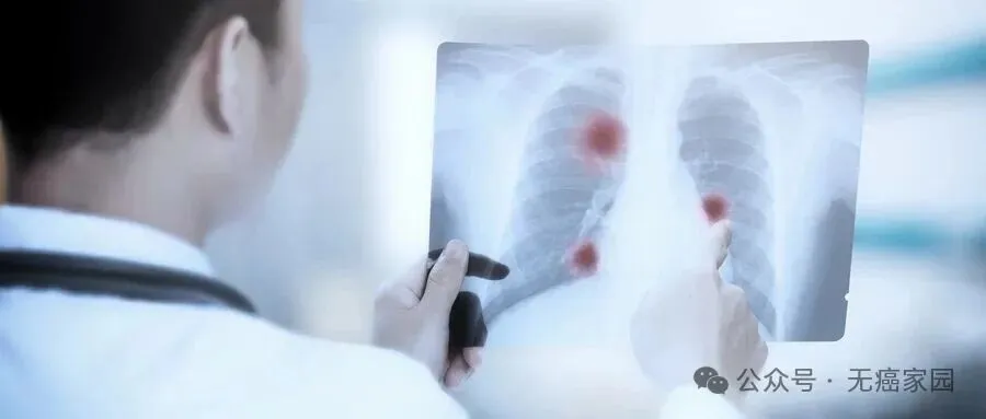 耐药不再是绝路！奥希替尼“搭档”谷美替尼获批临床，精准打击MET扩增实现长生存！