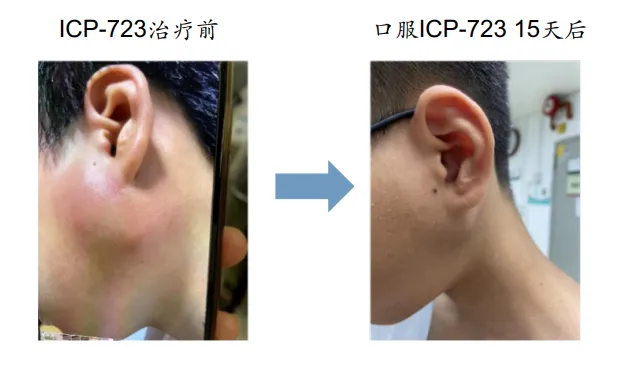 近90%患者肿瘤消退！革命性国研二代抗癌药上市！肺癌、肠癌、儿童肿瘤等全覆盖