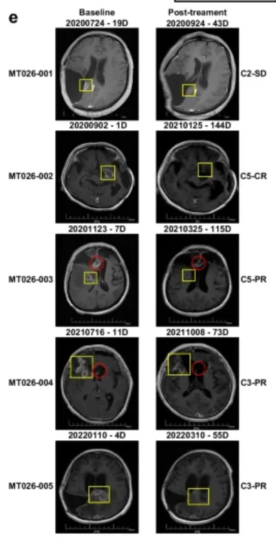 疾病控制率100%！疫苗、CAR-T、NK改写“死亡剧本”！2026脑瘤五大颠覆性疗法盘点